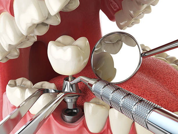 Best Root Canal Emergency Dentist  in Haven, KS